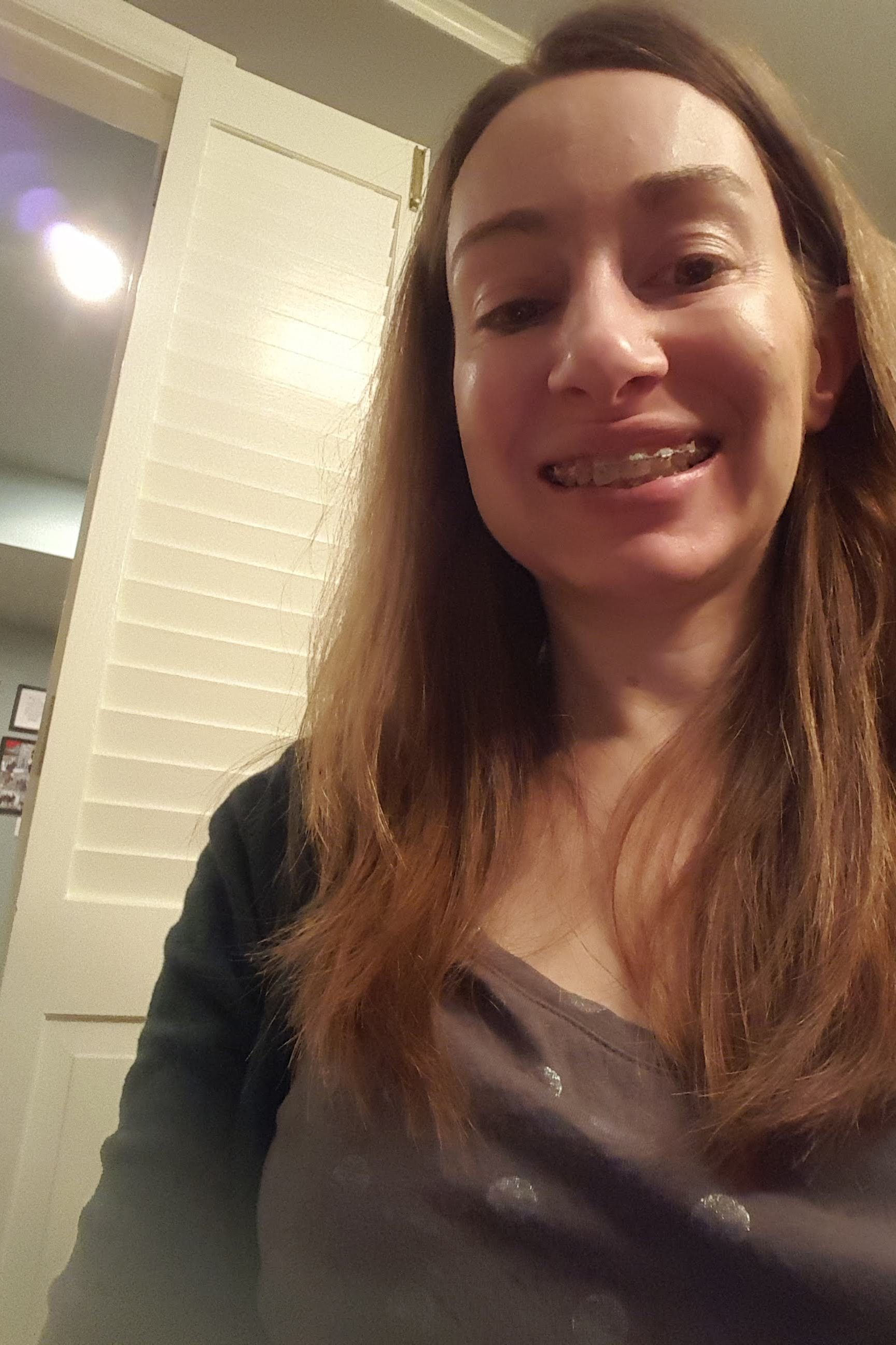 Braces as an Adult Progress, Month 23 | https://www.roseclearfield.com