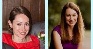 Before and After Adult Braces
